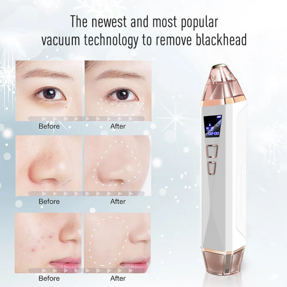 Femvy Purifying Pore Vacuum